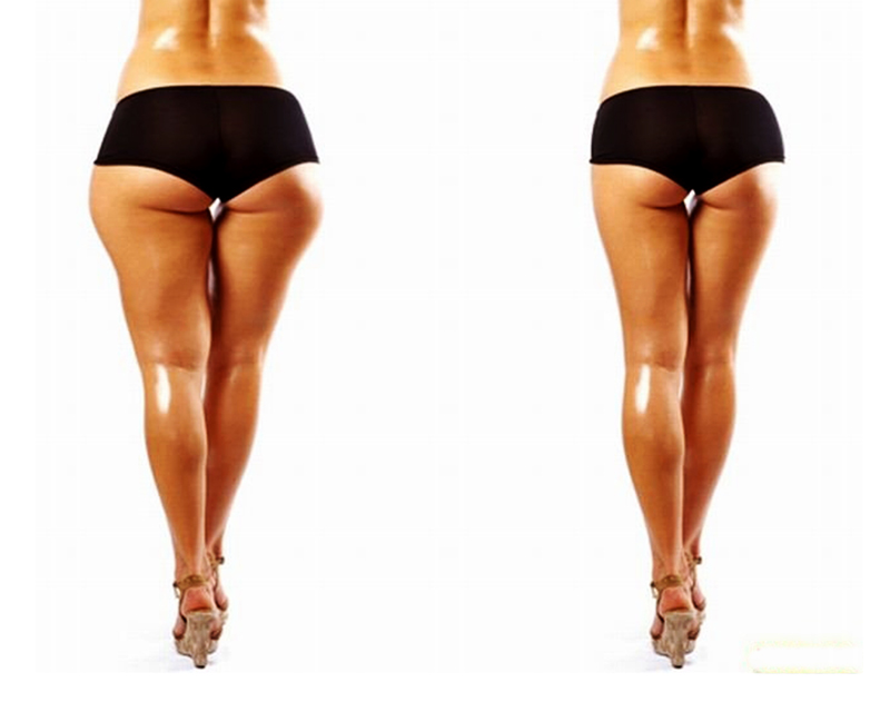 Body Sculptor Areton Limited