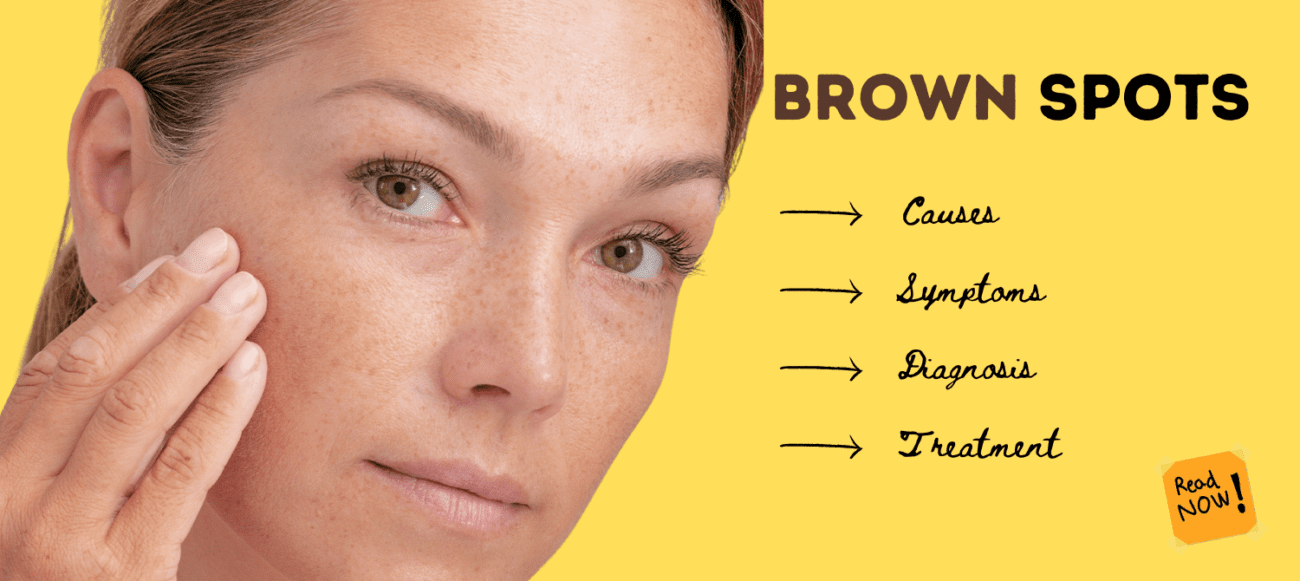 what are brown spots