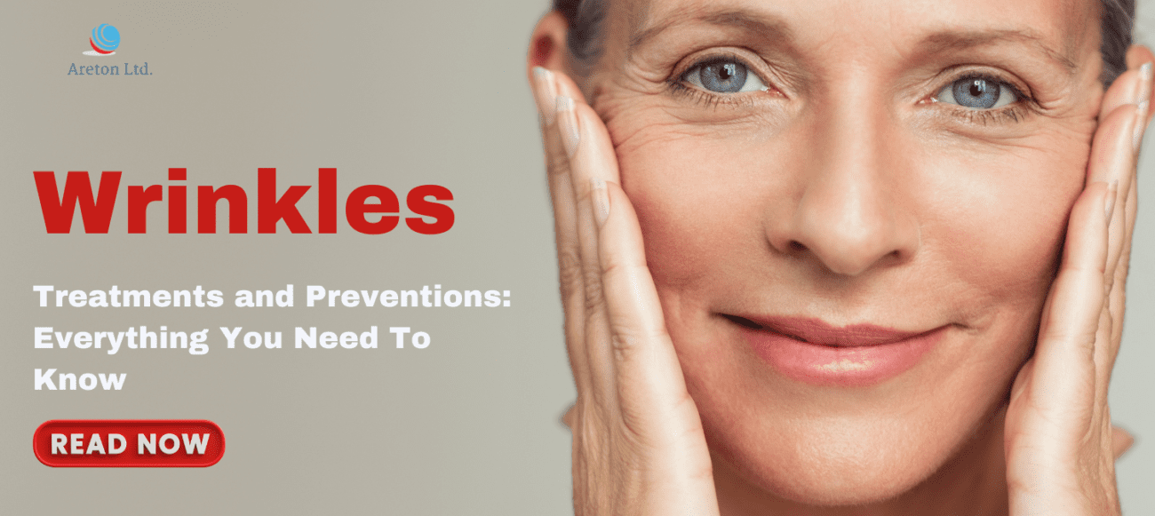 Wrinkles Causes, treatment, and prevention