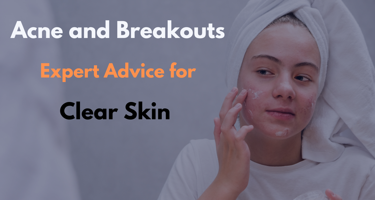 Acne and Breakouts